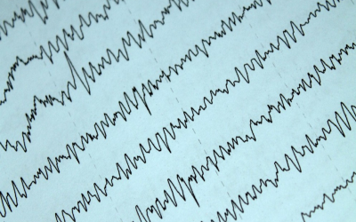DOCENTES Y ESTUDIANTES DEL BALSEIRO PARTICIPAN EN INVESTIGACIONES DE DIAGNÓSTICO Y TRATAMIENTO DE LA EPILEPSIA